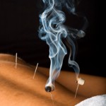 Acupuncturist Burning Moxa 