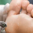 A gloved clinician using a rotary burr on hard skin across the sole of a foot