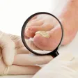 A gloved hand holding a magnifier over a thickened, discoloured big toenail