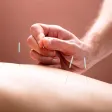 A practitioner placing a fine needle into a patient's back, with several already in place