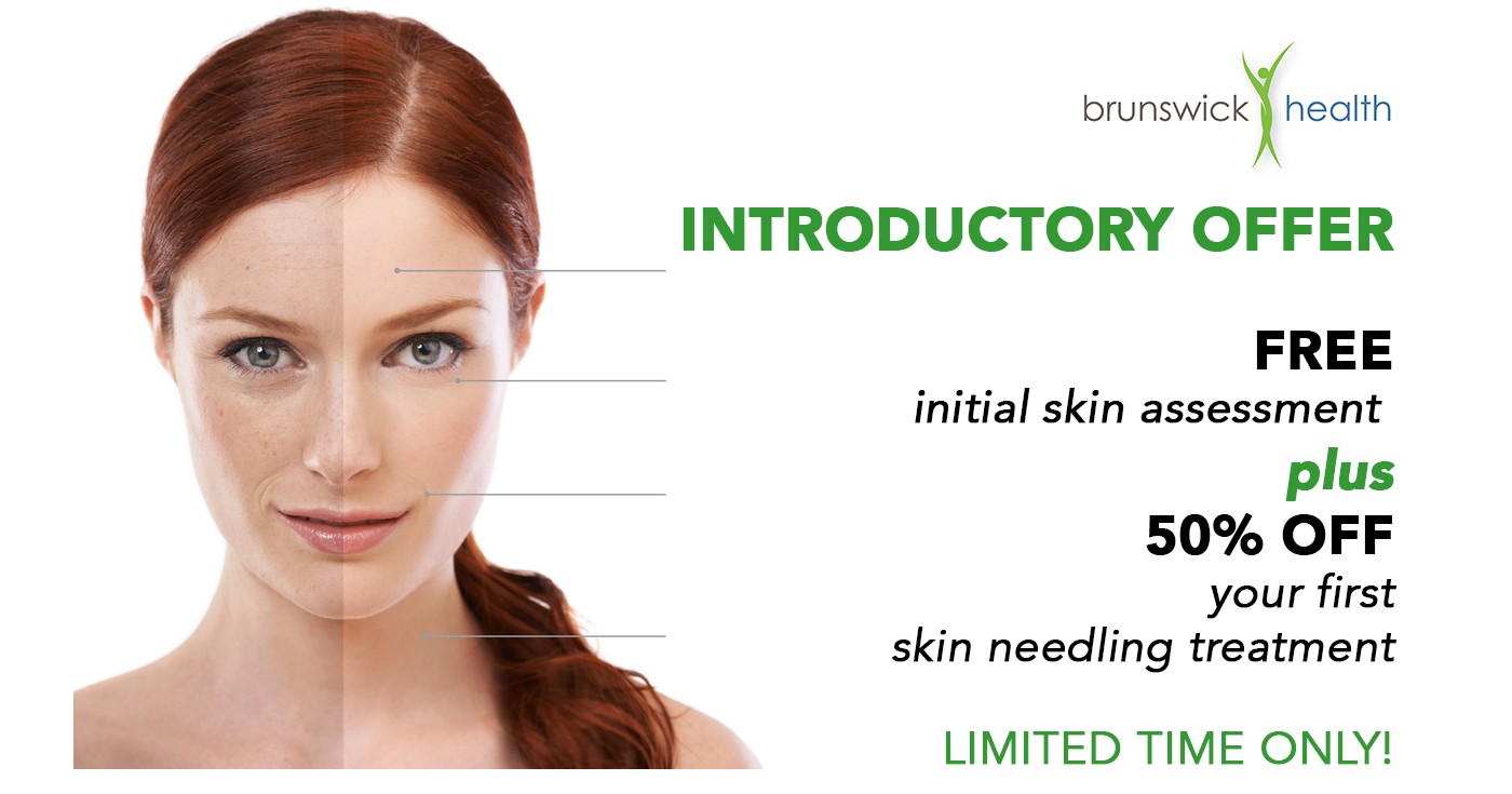 Skin Needling Introductory Offer - Free Assessment and 50% off your first treatment!