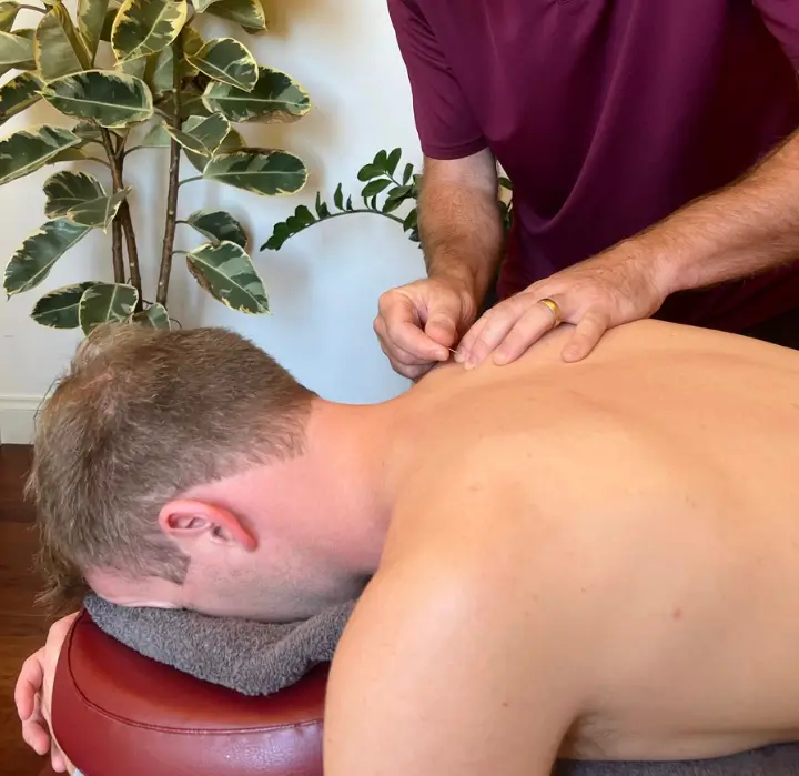 Melbourne acupuncturist performing dry needling on a patient's back in a therapy room with plants in the background