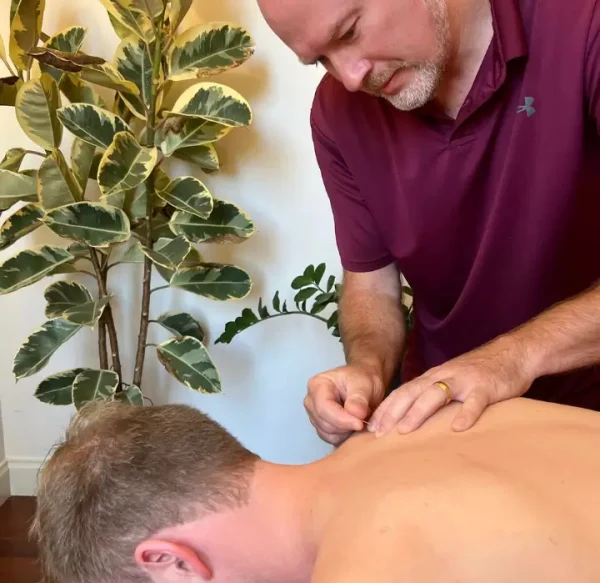 Massage therapist performing dry needling on a patient's back in a therapy room