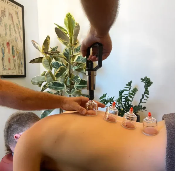 Massage therapist performing cupping therapy on a patient's back in a therapy room with anatomical charts and plants