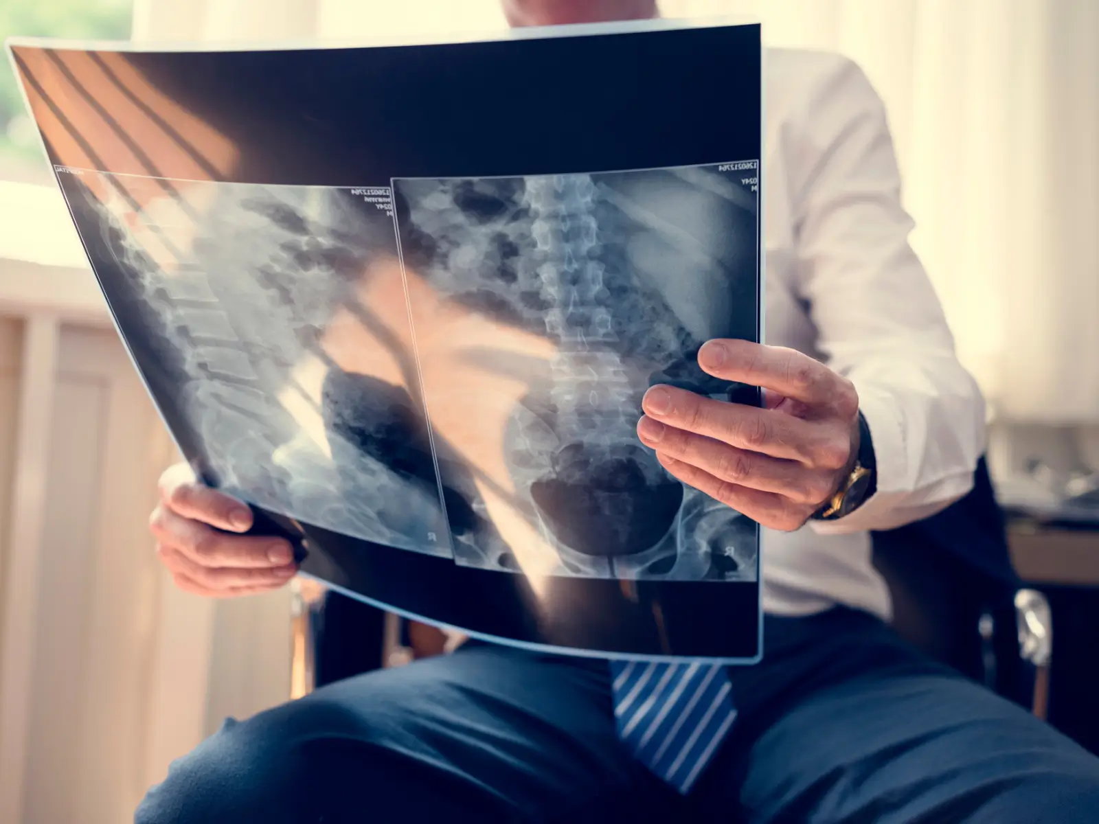 Professional in a suit examining a lumbar spine X-ray, analyzing details for diagnosis of conditions like low back pain or sciatica