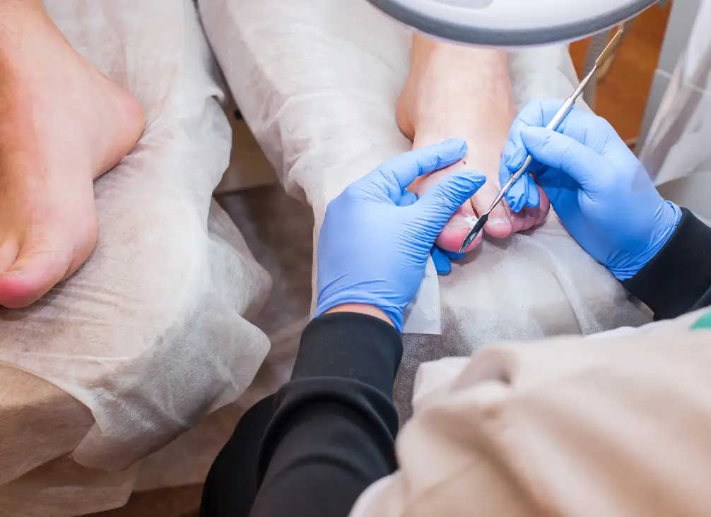 Podiatrist performing a professional foot treatment with sterile tools